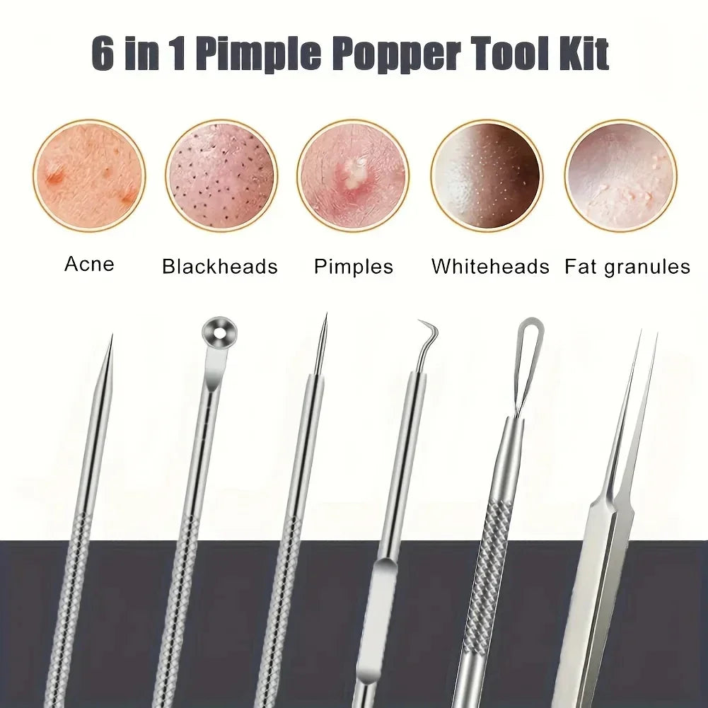 6Pcs Ultra-Precise Pimple Tweezers Set – Acne & Blackhead Removal Tool