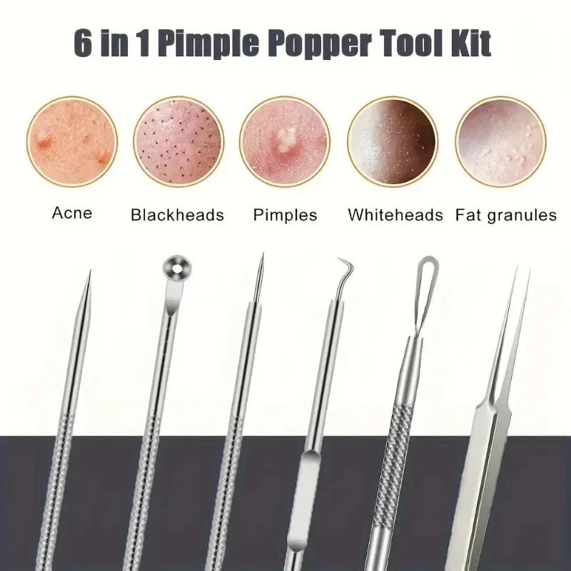 6Pcs Ultra-Precise Pimple Tweezers Set – Acne & Blackhead Removal Tool