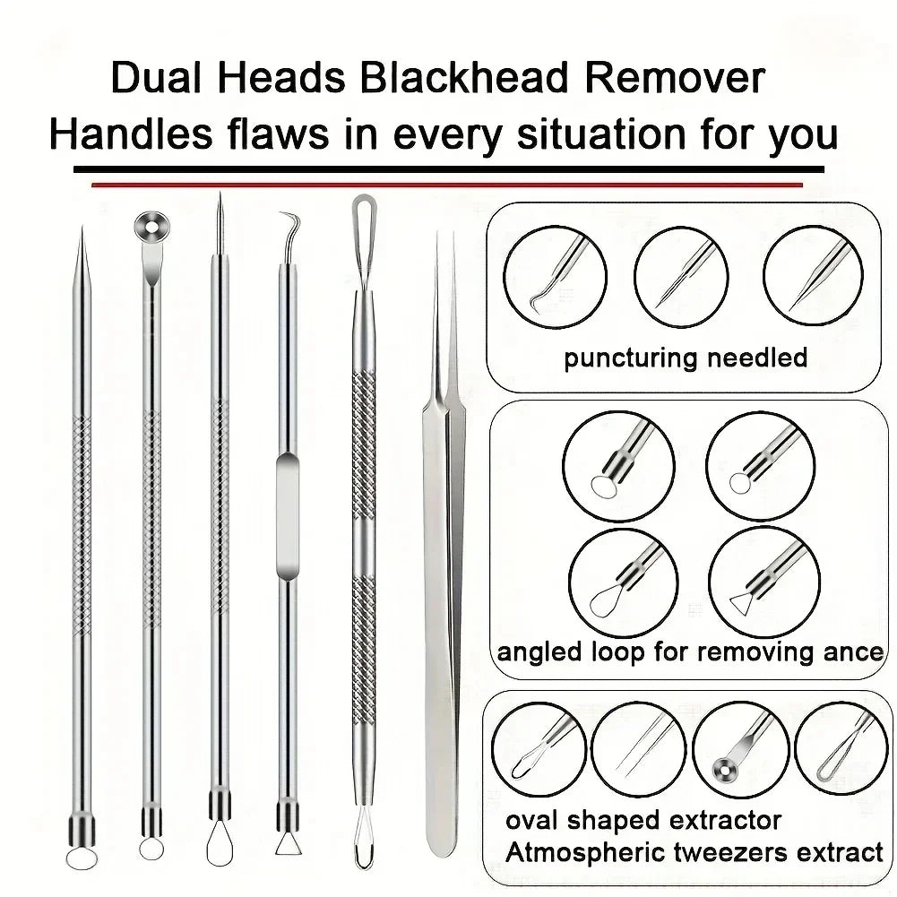 6Pcs Ultra-Precise Pimple Tweezers Set – Acne & Blackhead Removal Tool